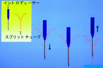 イントロデューサーの取扱い方法 イントロデューサーの取扱い方法